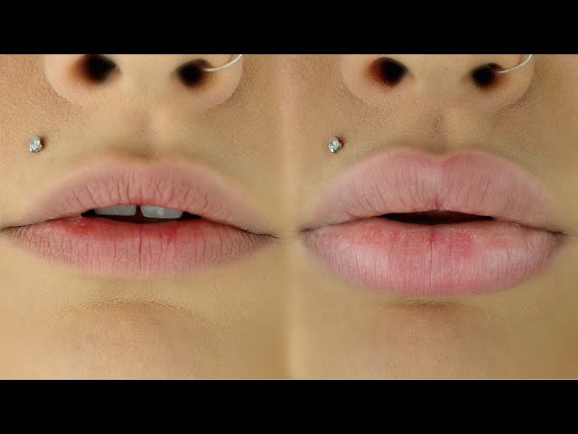 Get the Big Lip Look Naturally (Avoid These Mistakes!)